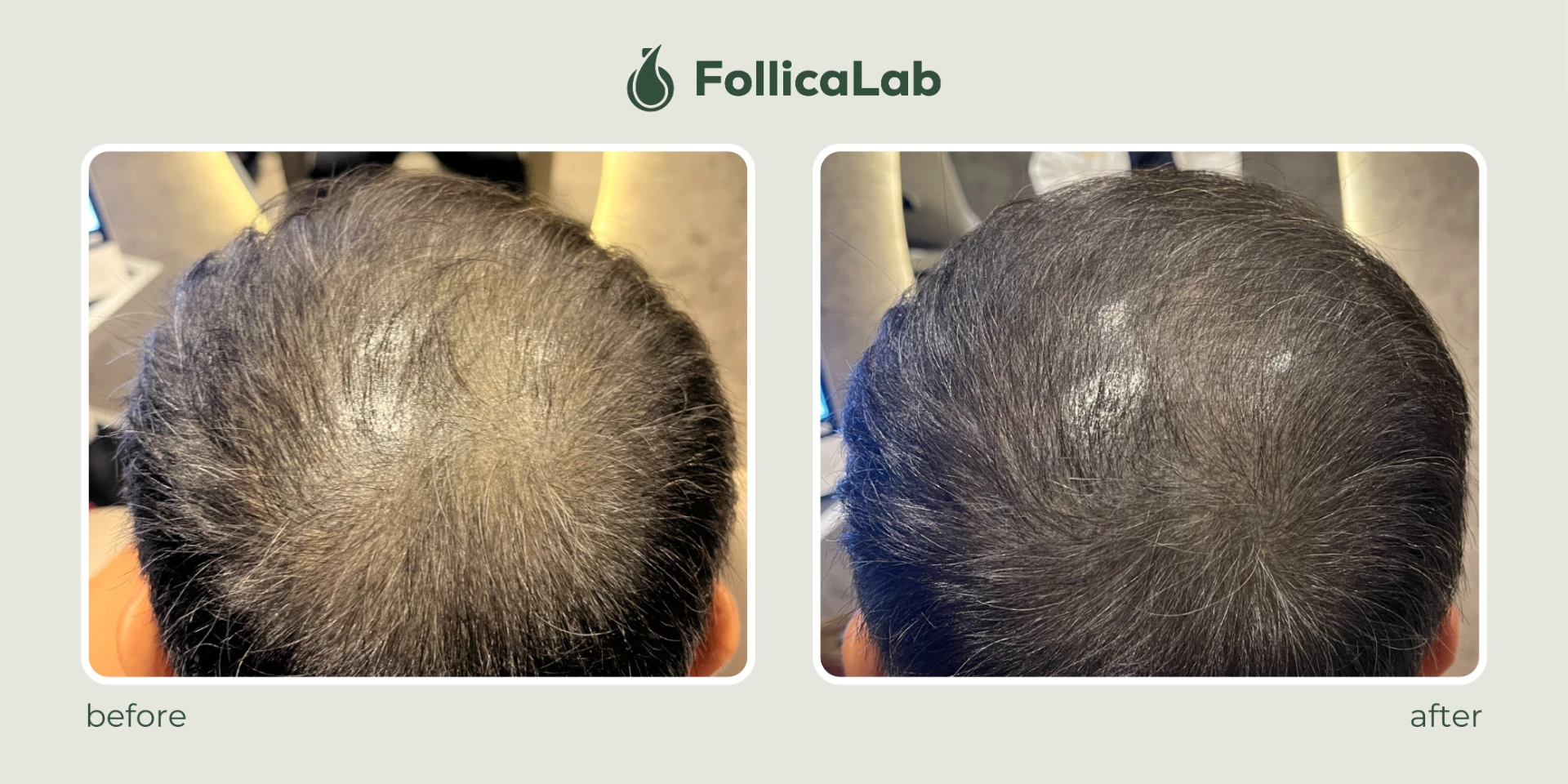 Follica Lab Customer Testimony 1