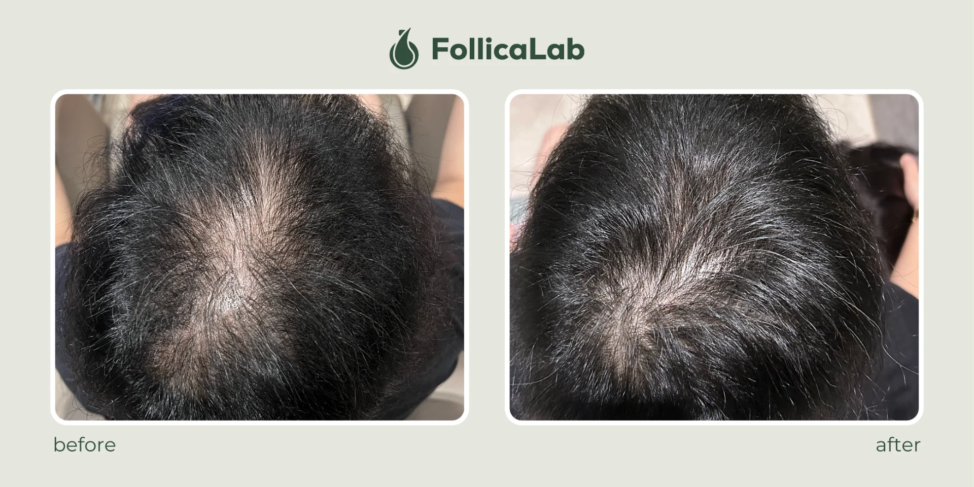 Follica Lab Customer Testimony 3