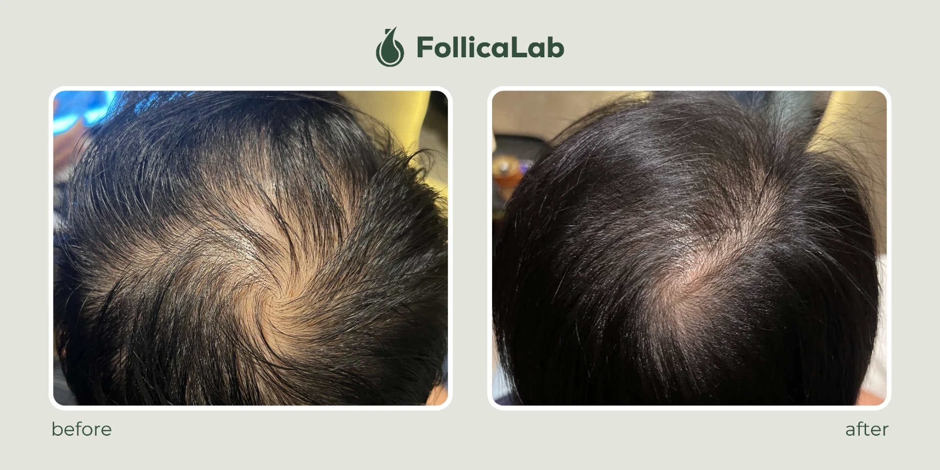 Follica Lab Customer Testimony 5