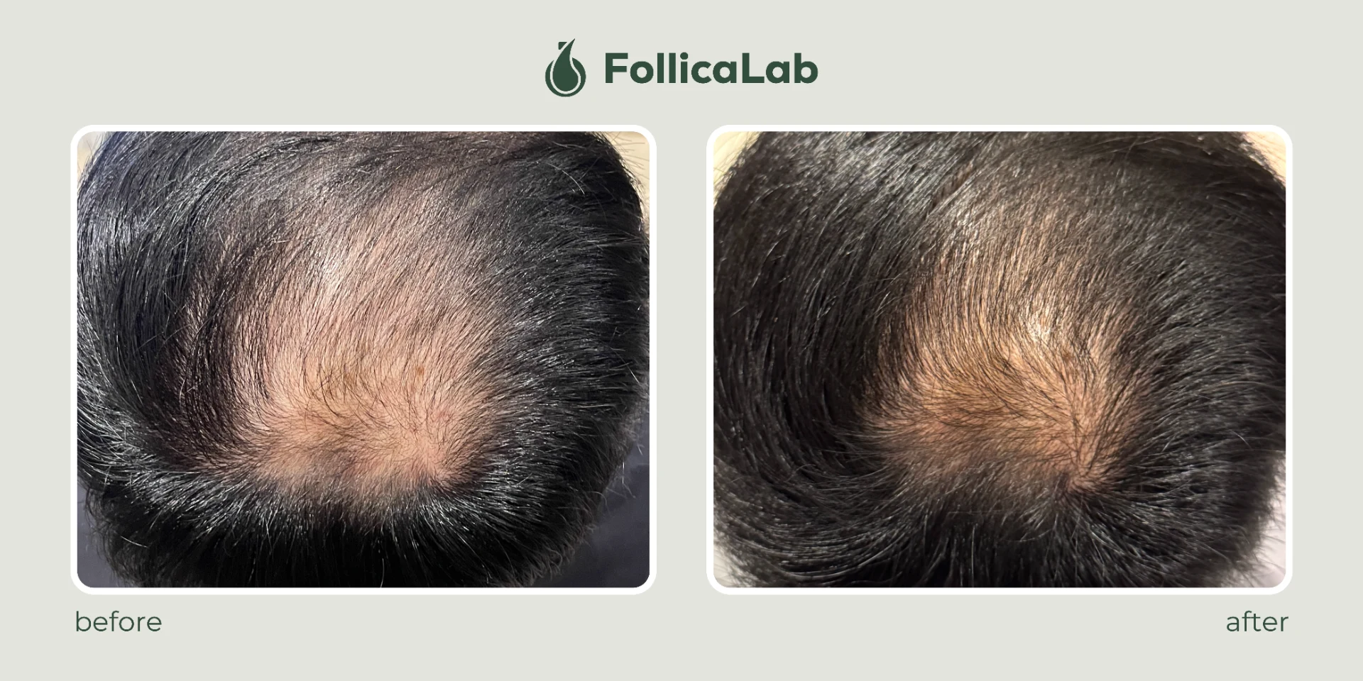 Follica Lab Customer Testimony 7