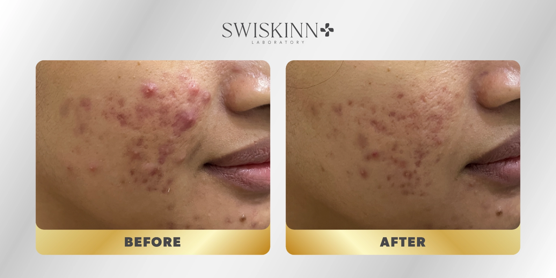 Swiskinn Customer Testimony 1