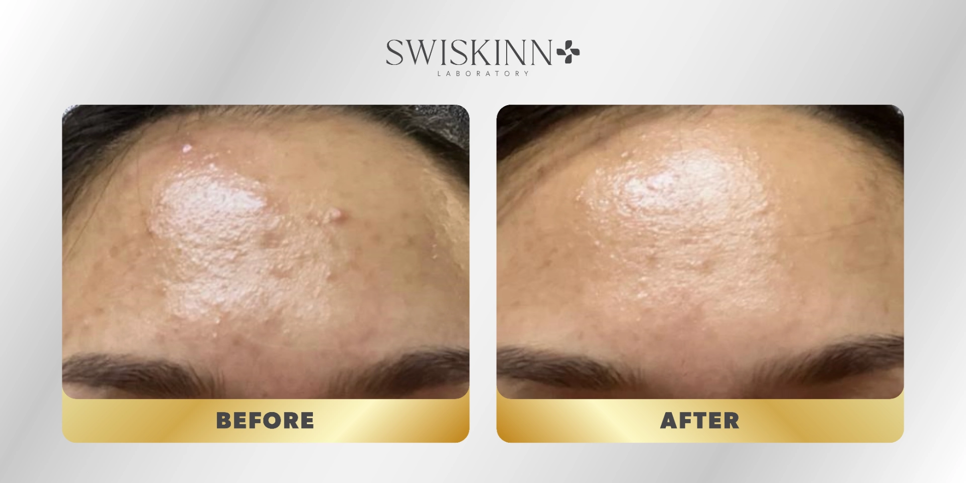 Swiskinn Customer Testimony 2
