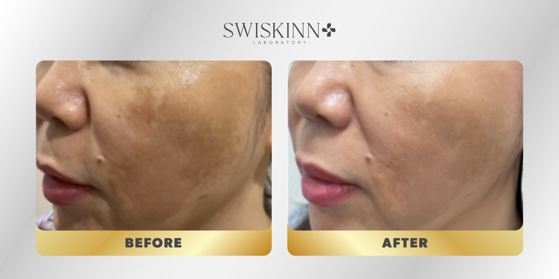 Swiskinn Customer Testimony 3