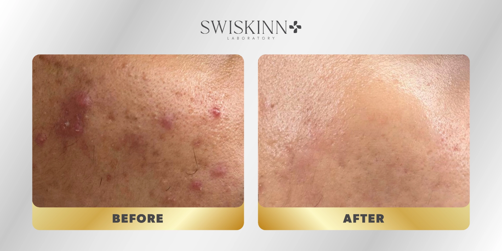 Swiskinn Customer Testimony 4