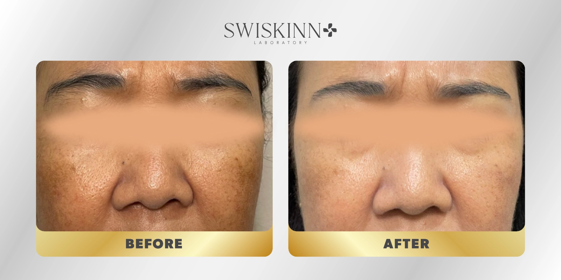 Swiskinn Customer Testimony 5
