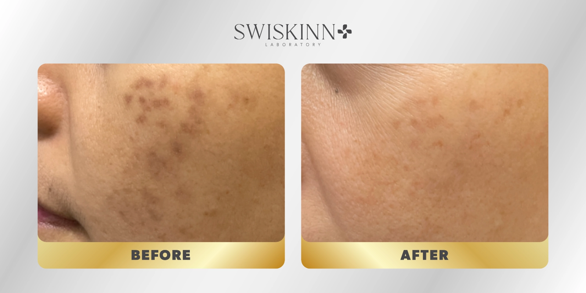 Swiskinn Customer Testimony 6