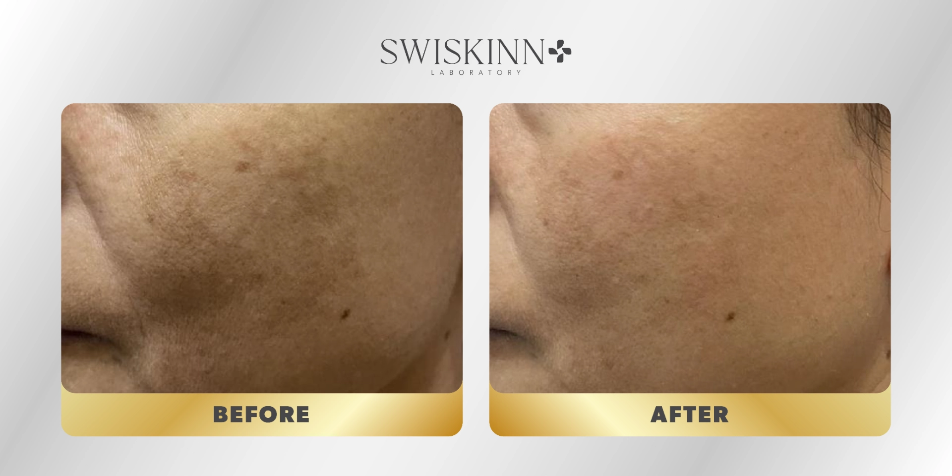 Swiskinn Customer Testimony 7