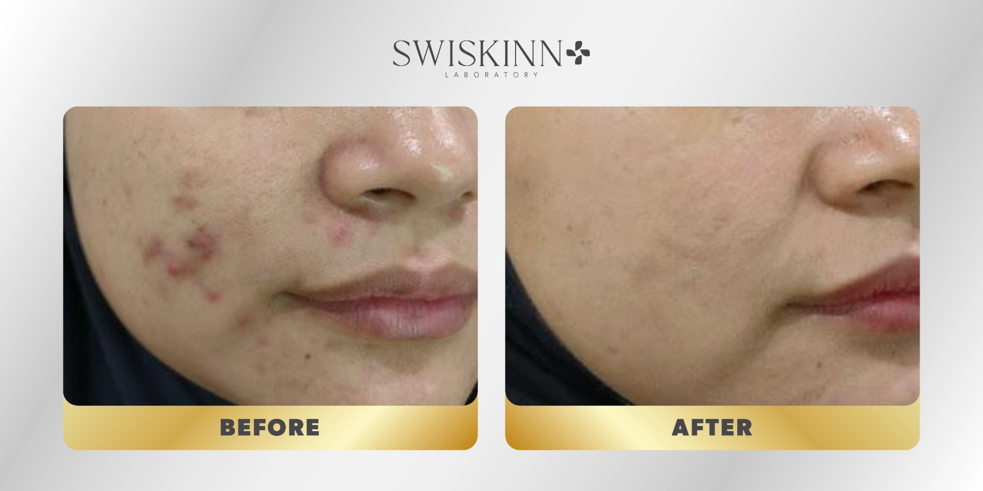 Swiskinn Customer Testimony 8